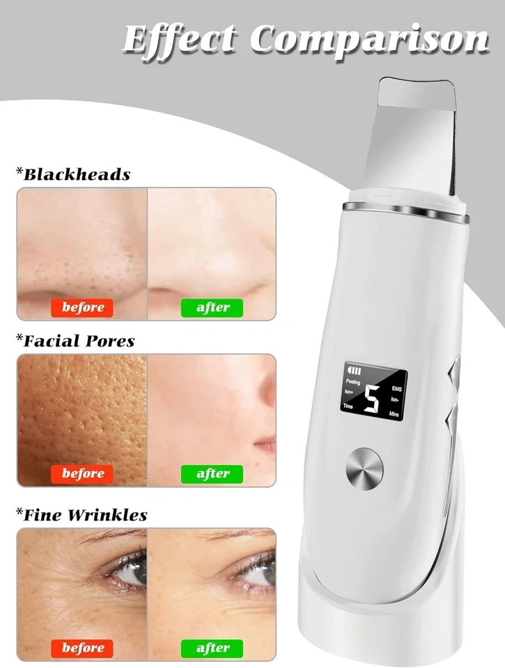 Skin Scrubber Face Spatula, 4 in 1 Blackhead Remover Tool for Pore Cleaner facia