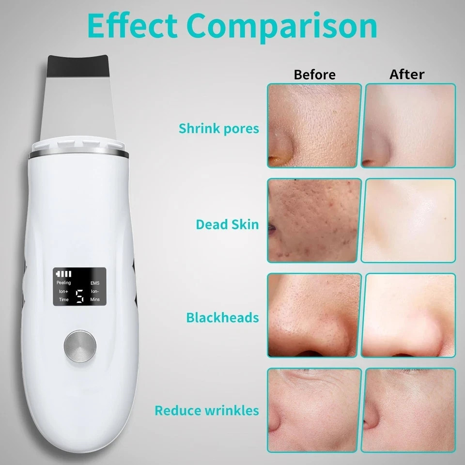 Skin Scrubber Face Spatula, 4 in 1 Blackhead Remover Tool for Pore Cleaner facia