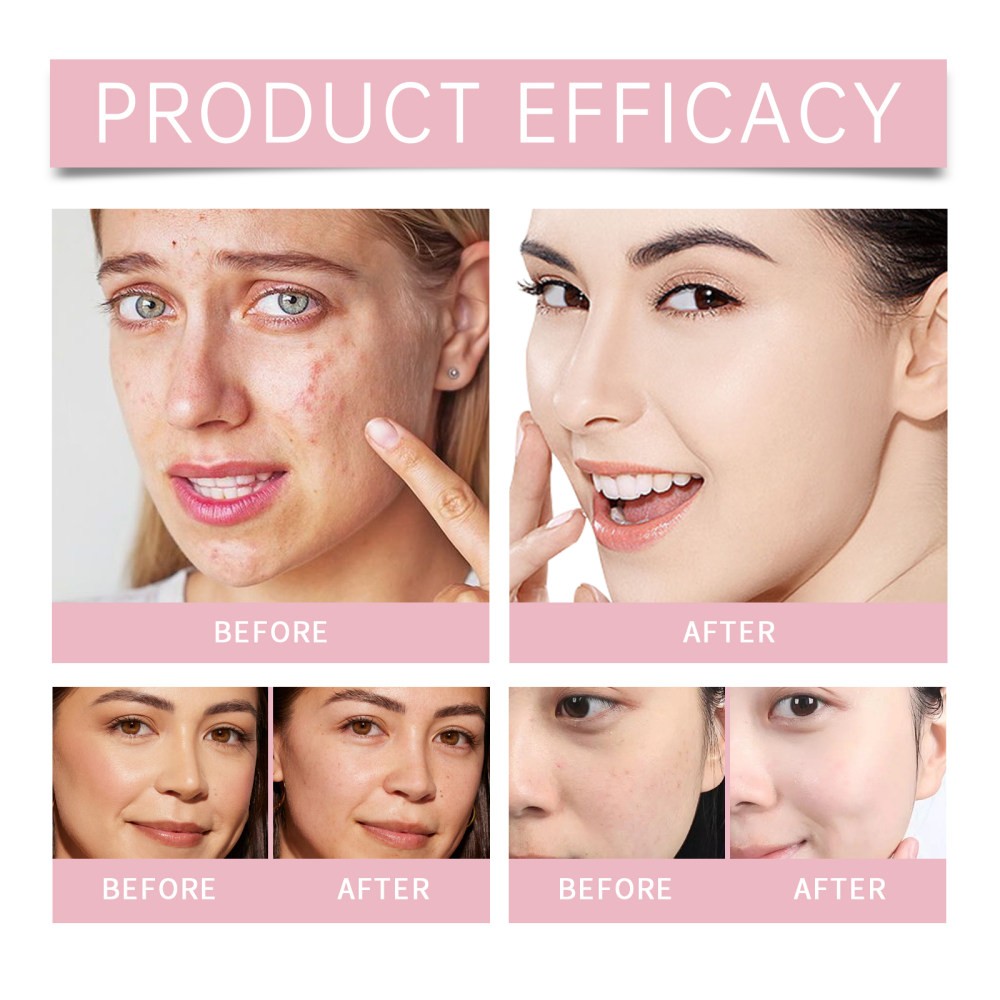 e Soothing Cleansing Cre ntle Cleansing Facial Pores