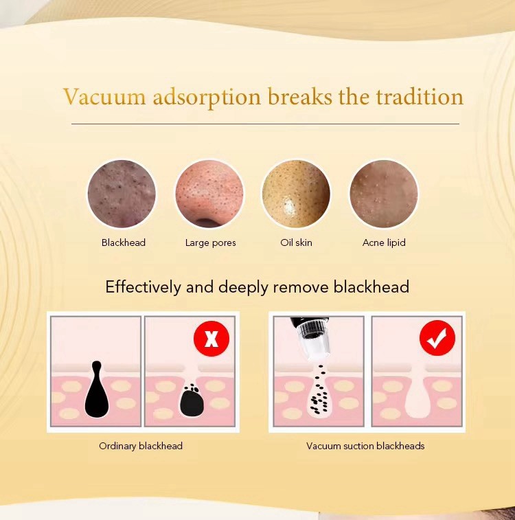 Electric Vacuum Blackhead Remover Pore cleaner With 5Suction Heads & LED Display