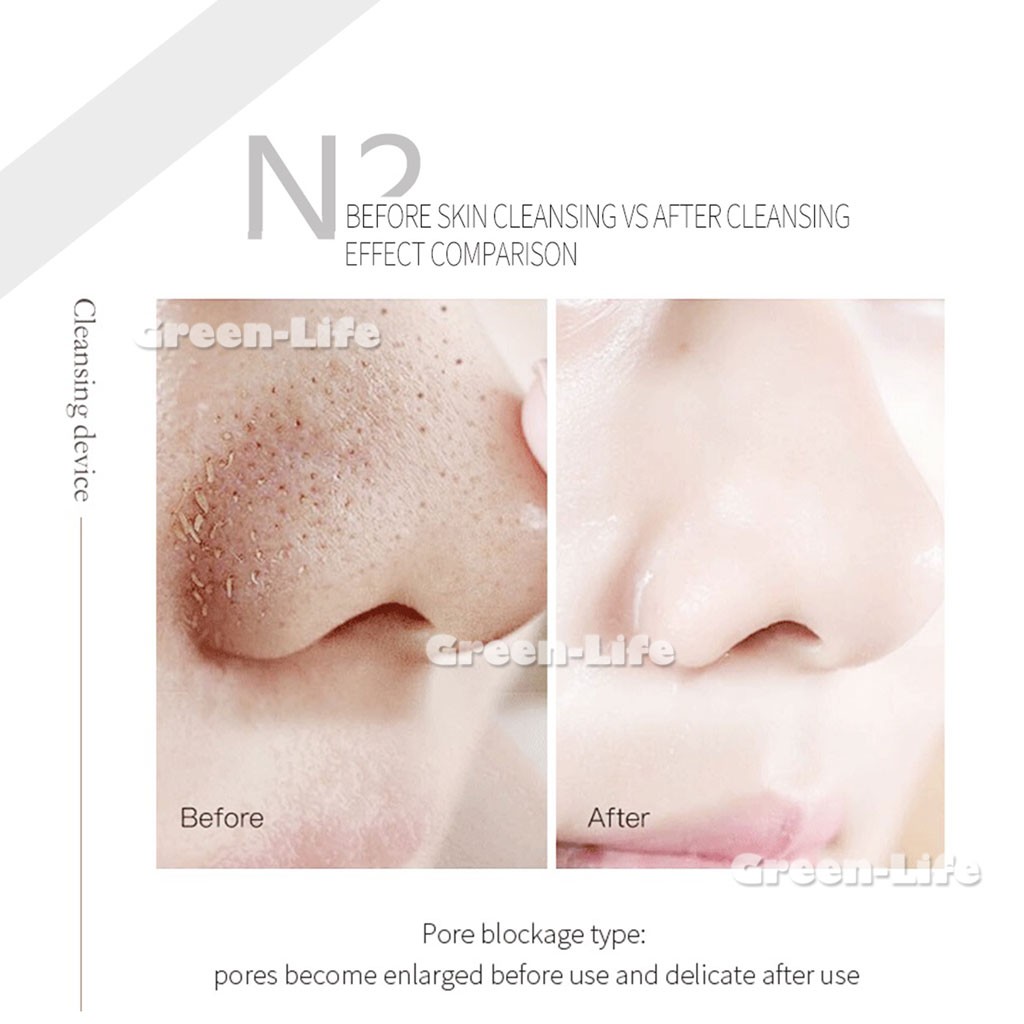 Face Small Bubble Cleaning Blackhead Acne Device Oxygen Bubble Machine Care Skin