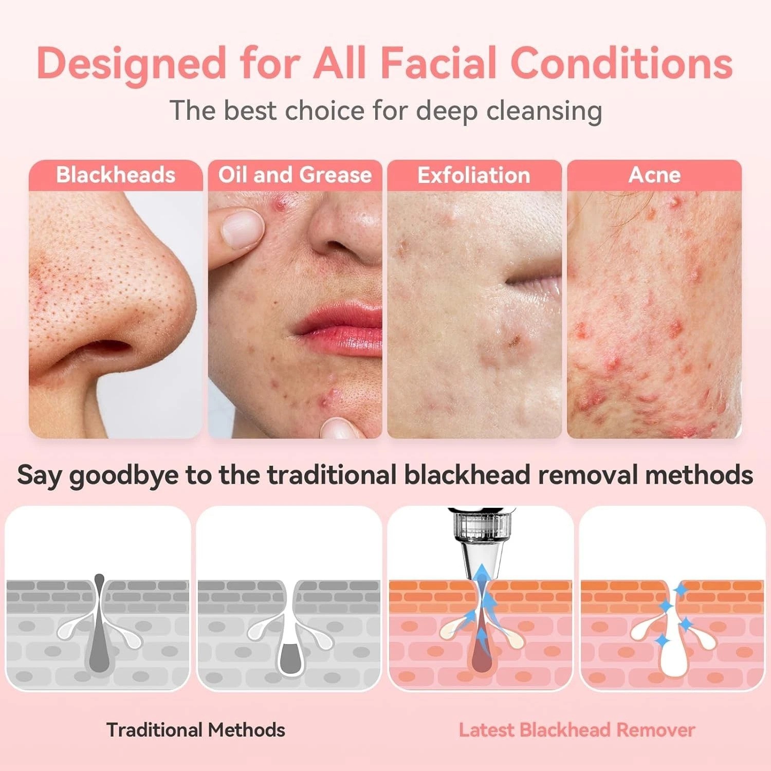 Blackhead Remover Pore Vacuum Upgraded Facial Pore Cleaner Electric Comedone …