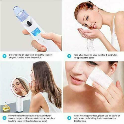 Rechargeable Pore Vacuum Blackhead Facial Remover Cleaner & Cupping Therapy Set