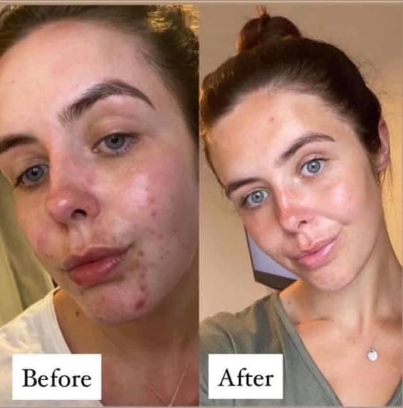 LumiSpa IO Skincare Device Facial Cleansing