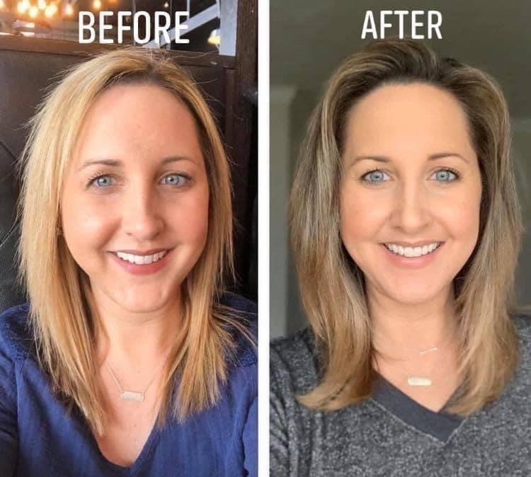 LumiSpa IO Skincare Device Facial Cleansing