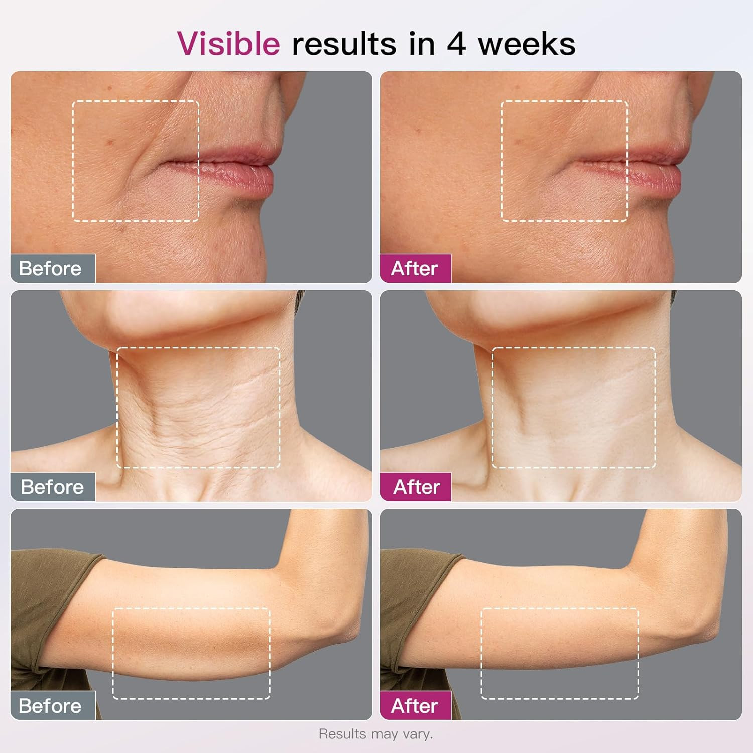 Microcurrent Facial Device 4-In-1 Beauty Device with Red Light Therapy and Blue
