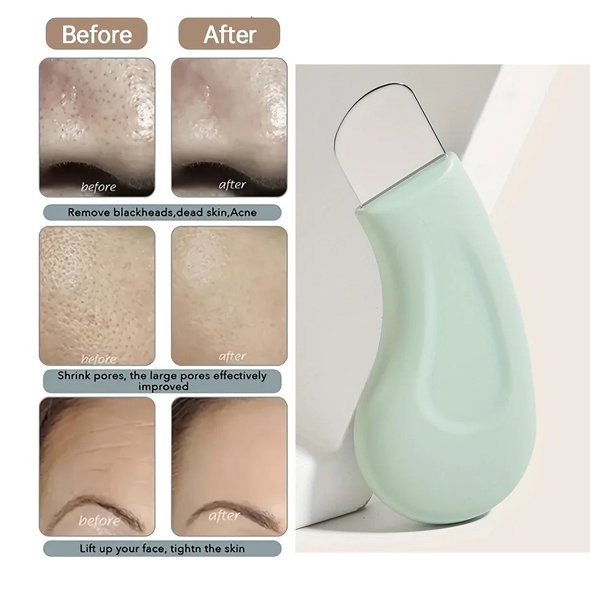 Blackhead and Whitehead Removal Tool for Nose and Face Skin Care Tool for Women