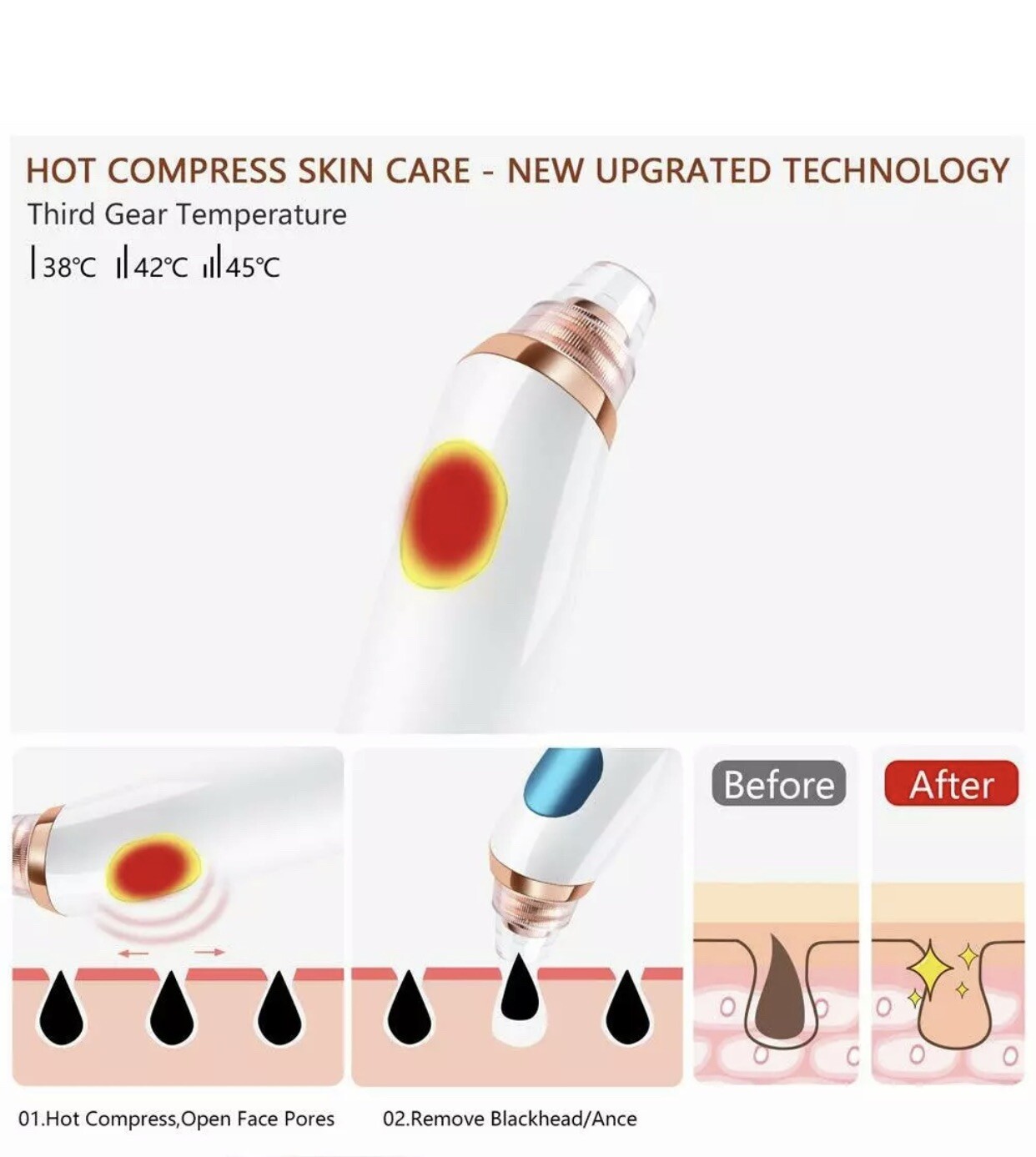 Blackhead Remover acne extractor hot compress, USB Pore Cleaner, LED display