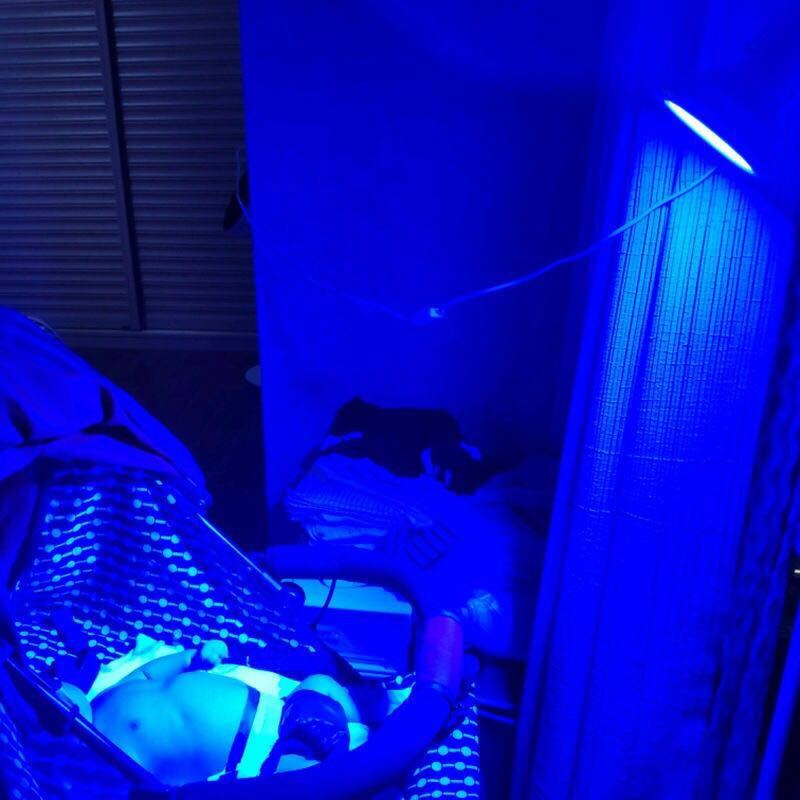 Neonatal jaundice blue light baby blue light baby jaundice blue light
