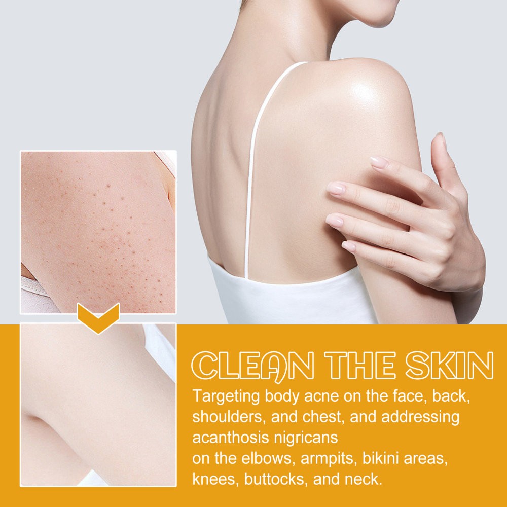 Spot Cleanser Deep Cleansing Facial Body Skin Fade Spot