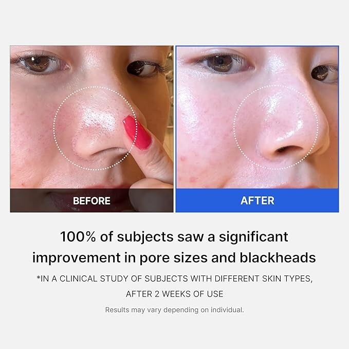 Medicube Zero Pore Pads 2.0 Dual-Textured Facial Toner Pads for Exfoliation