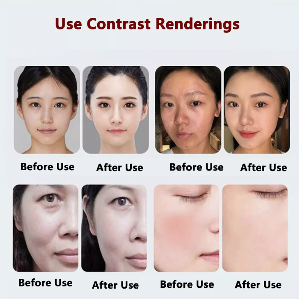 Beauty Appliances Skin Tightening Water Peeling Oxygenated Facial Machine