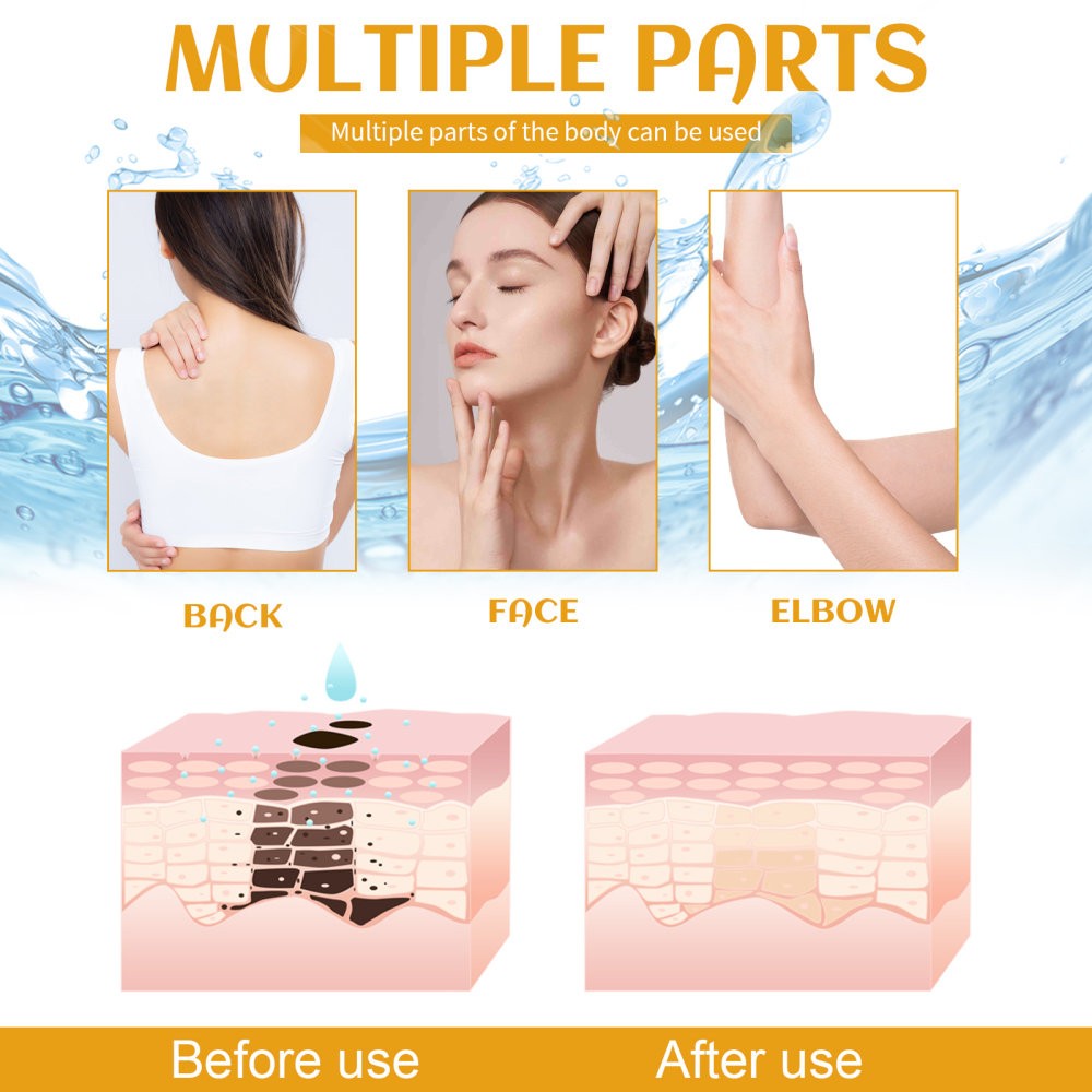 Spot Cleanser Deep Cleansing Facial Body Skin Fade Spot