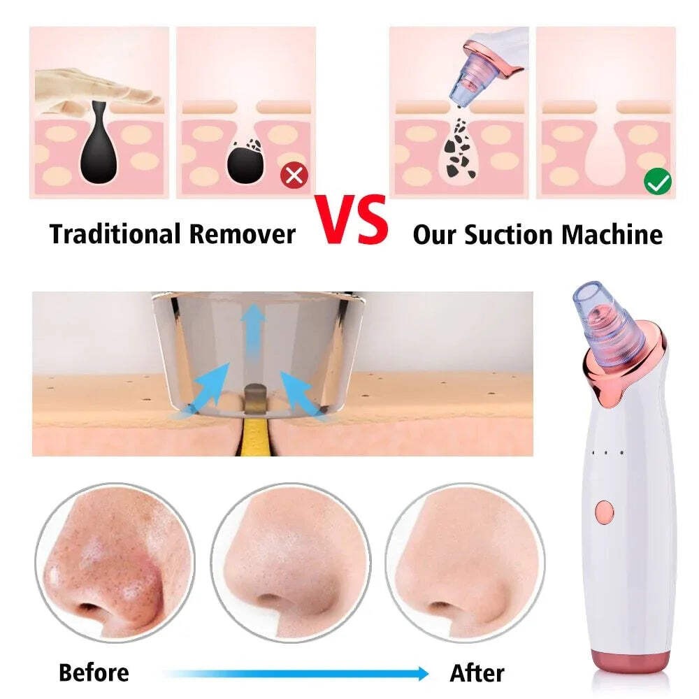 Blackhead Instrument Electric Suction Facial Washing Instrument Beauty Acne Clea