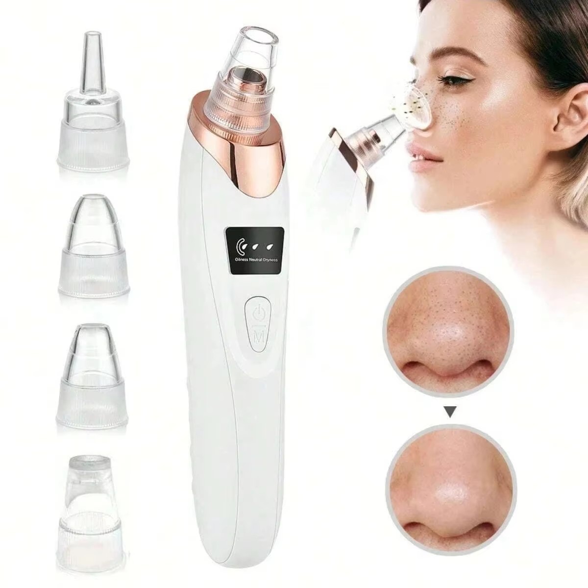 Electric Blackhead Remover Vacuum 5 Suction Pore Cleanser