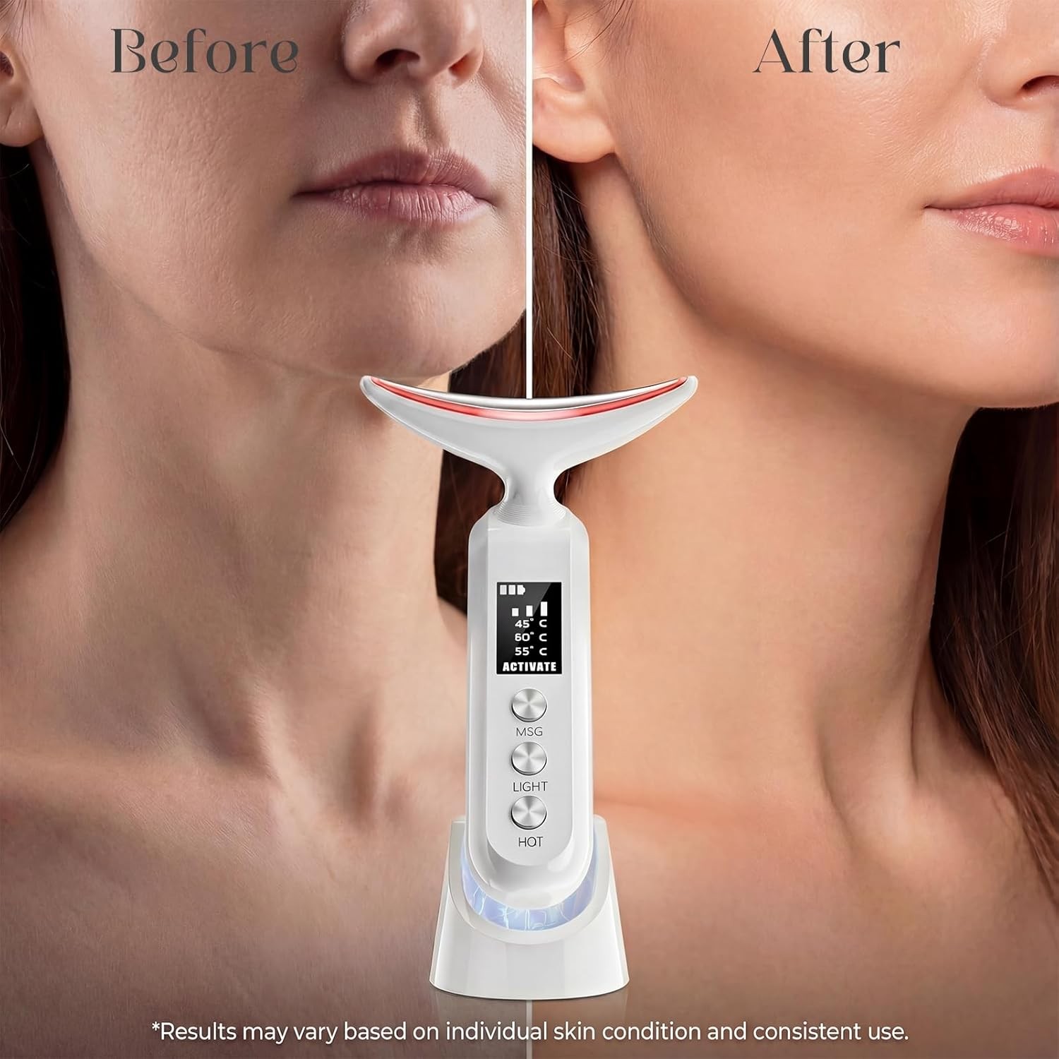 9Color LED Face Massager Neck Wrinkles Tightening Wand Skin Care Vibration White