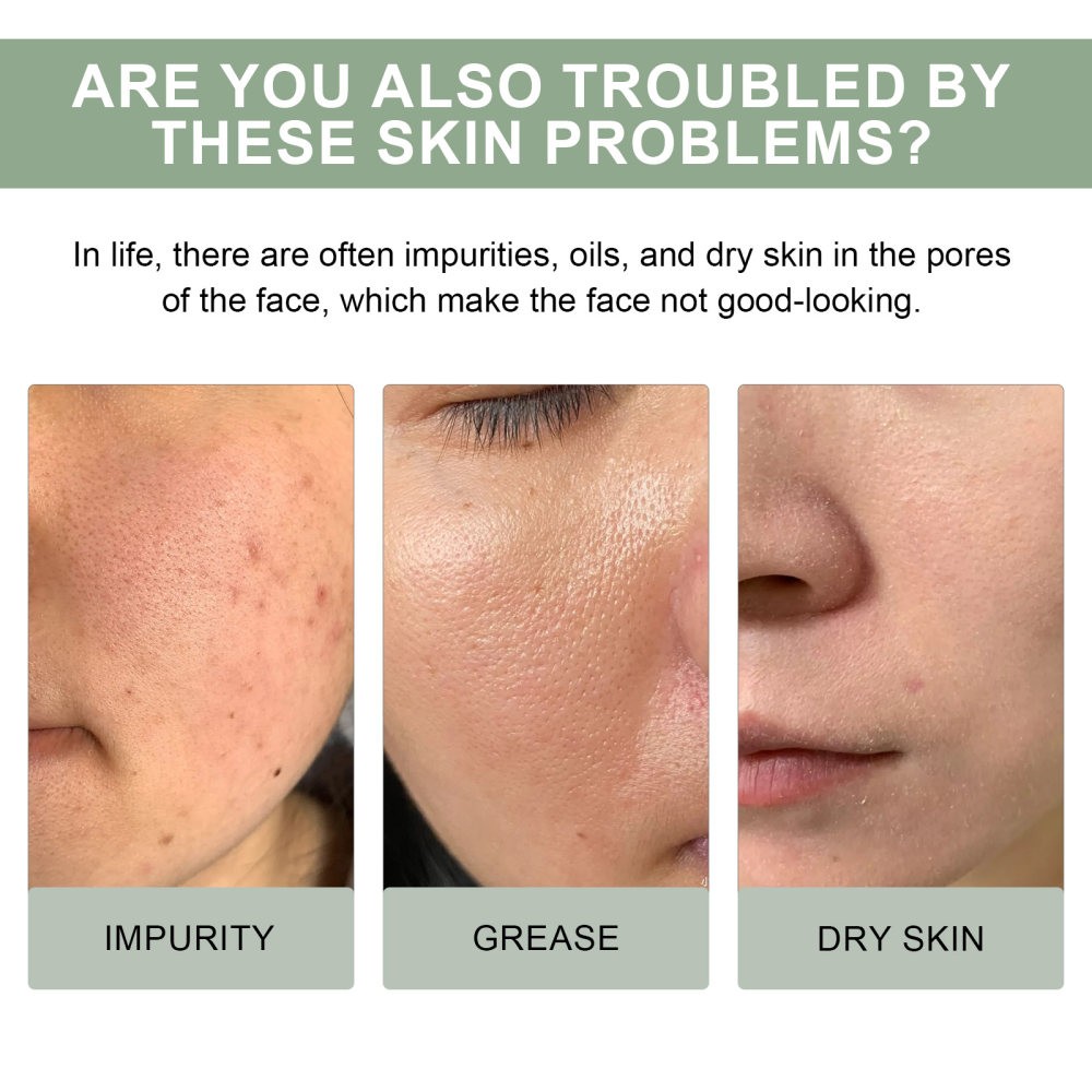 Pore Cleansing Cleanser Facial Skin Brightening Deep Cleansing