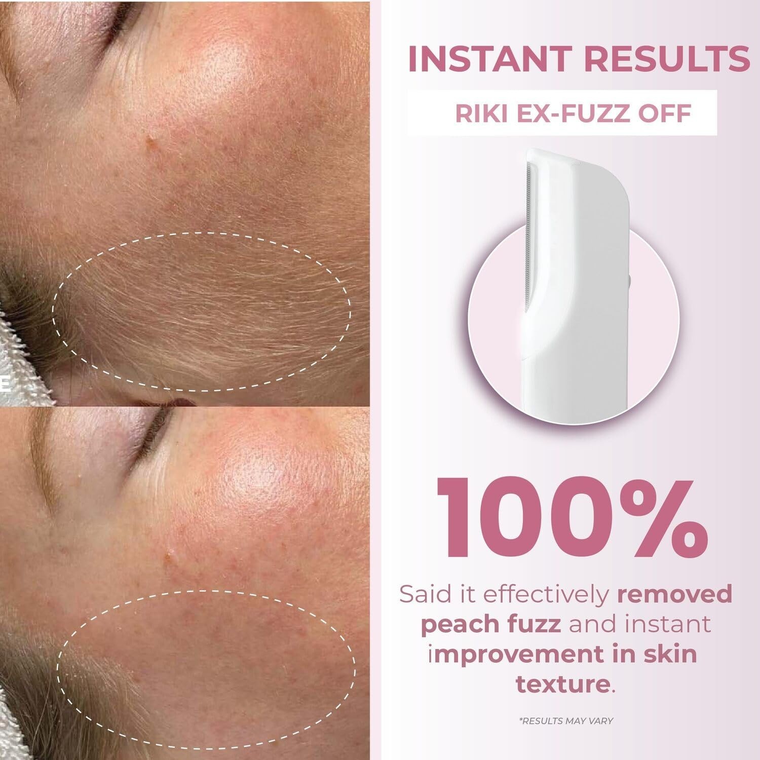 Stainless Steel Facial Razor for Peach Fuzz Removal & Gentle Exfoliation Tool
