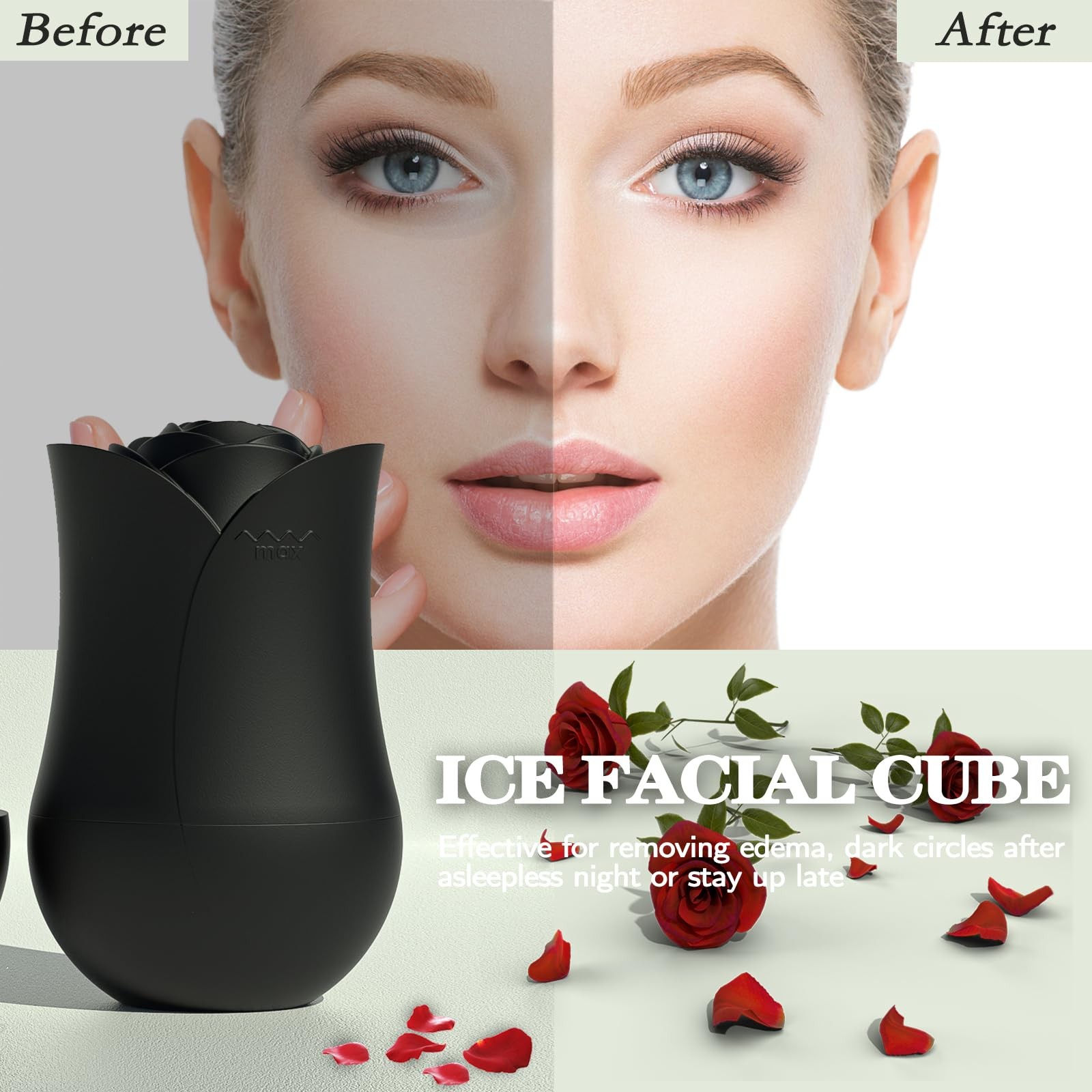 Xkmiess Ice Roller For Face，Cryo Cube Facial And Black
