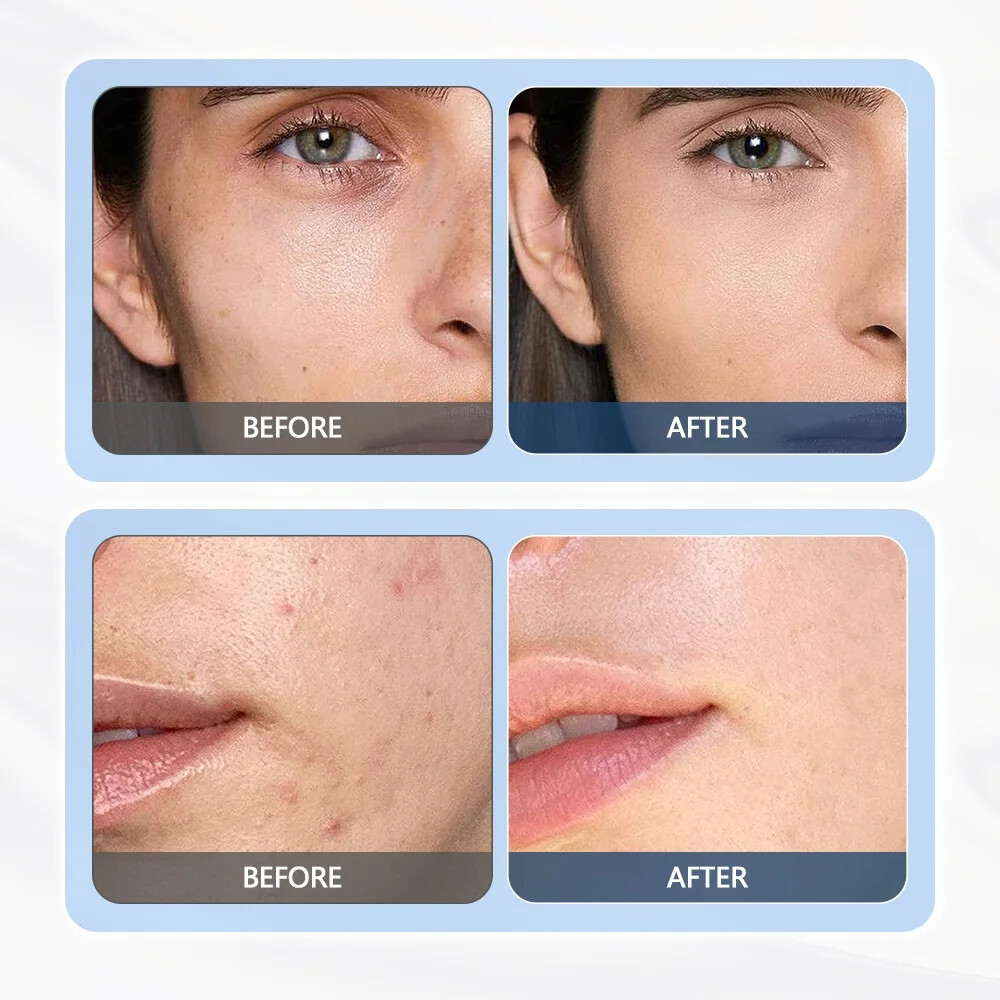 3 In 1 Facial Beauty Device Face Lifting Eye Massage Skin Care Essence Booster