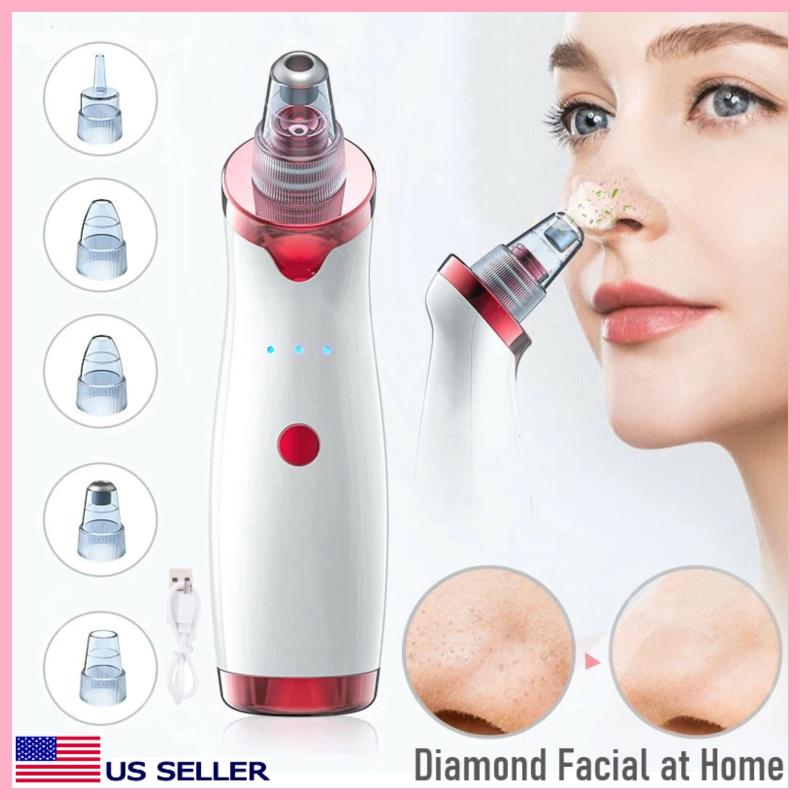 Blackhead Remover Vacuum Diamond Face Cleaner Pore Vacuum Suction White Heads