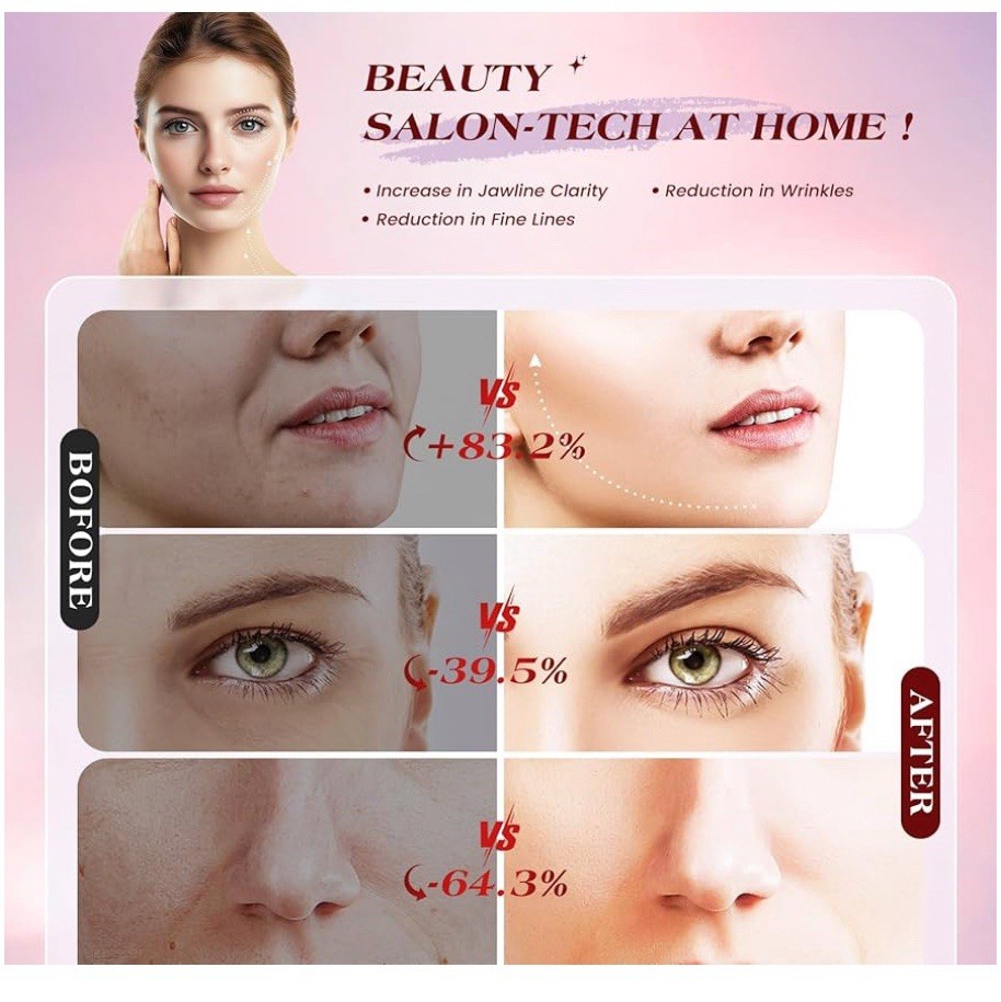 INTEO Microcurrent Facial Device 3 Modes Red Light Therapy for Face & Neck(Gold)