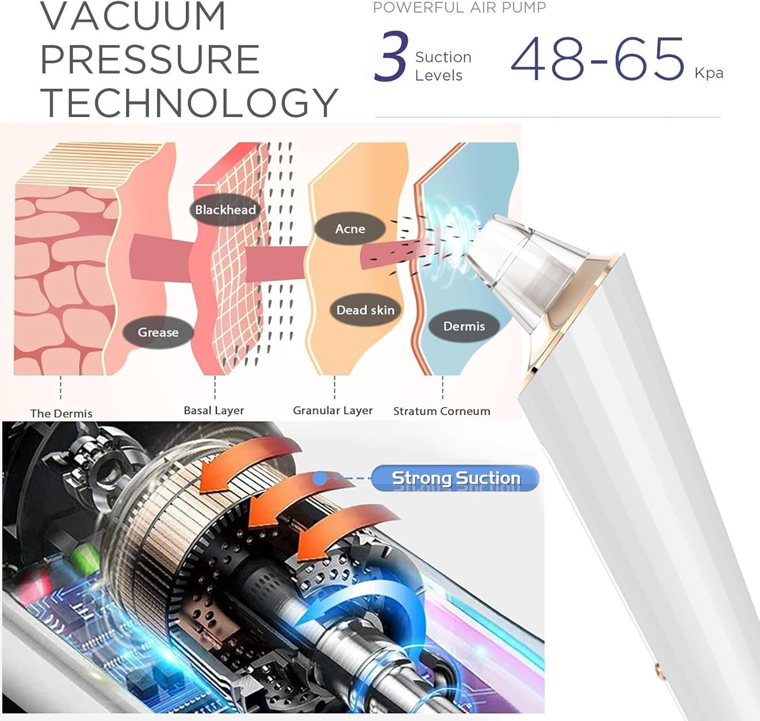 Blackhead Remover Pore Vacuum, Upgraded USB Rechargeable Facial Pore Cleaner …