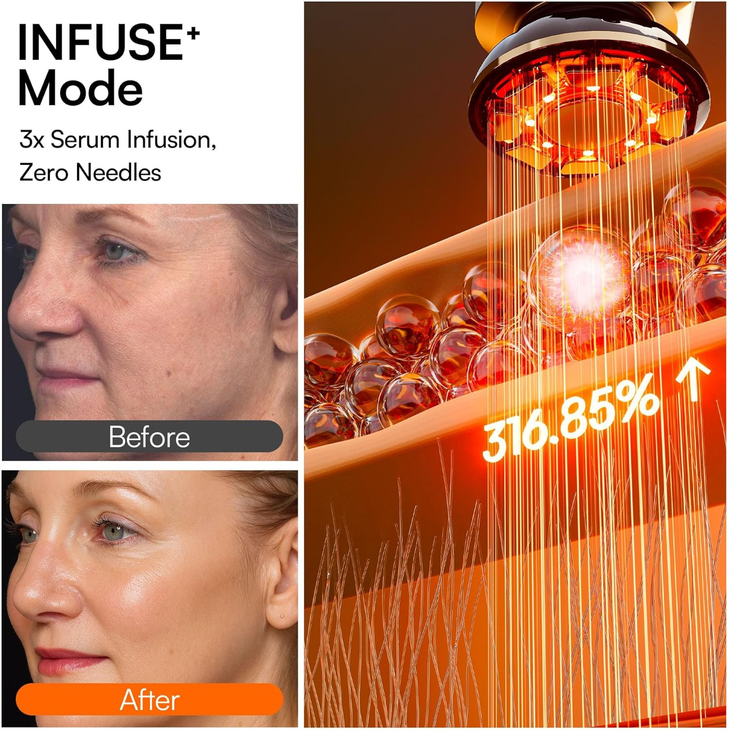 Flare 3-In-1 Microcurrent Facial Device Red Light Therapy for Face and Neck Mass