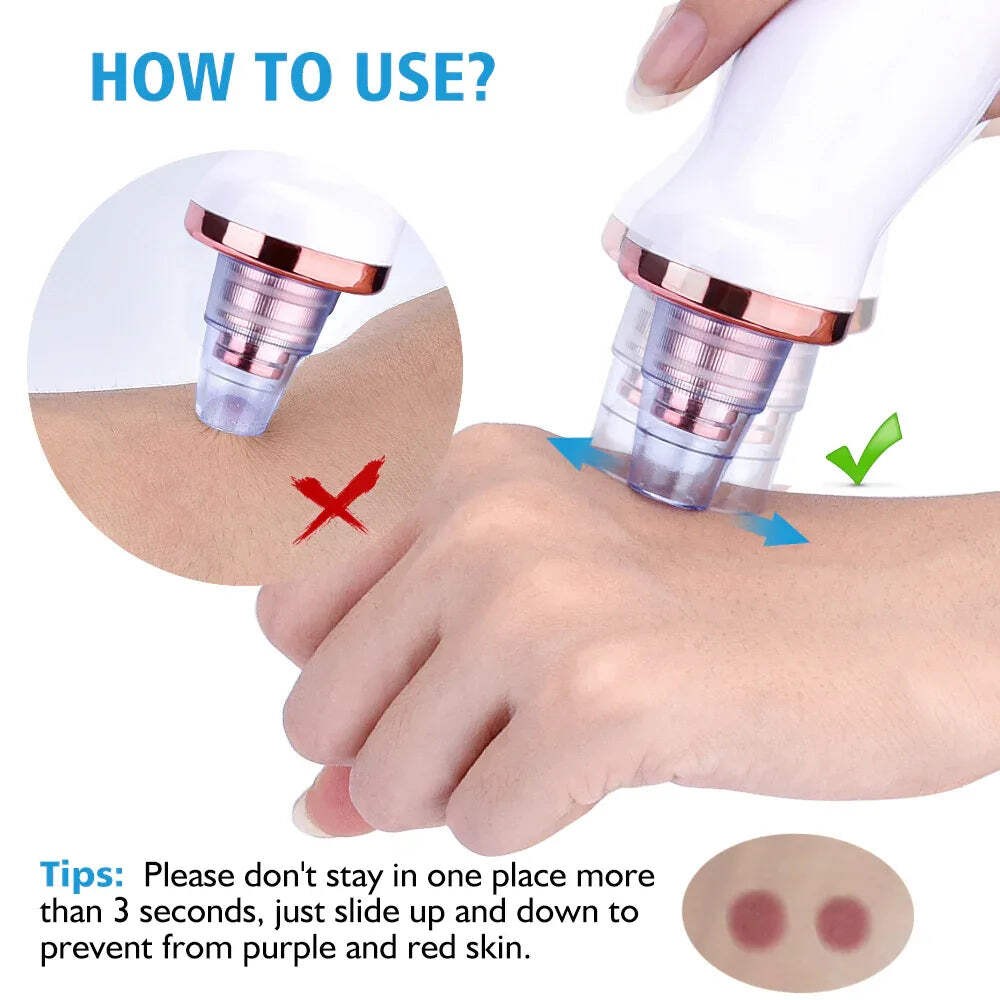 Blackhead Instrument Electric Suction Facial Washing Instrument Beauty Acne Clea