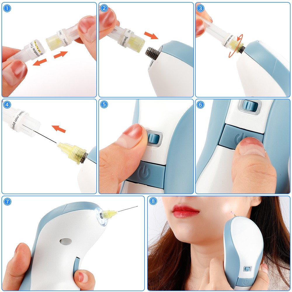 10-100pcs Replace Components- 21mm For 4TH Generation Plasma Pen Anti-Aging Tool