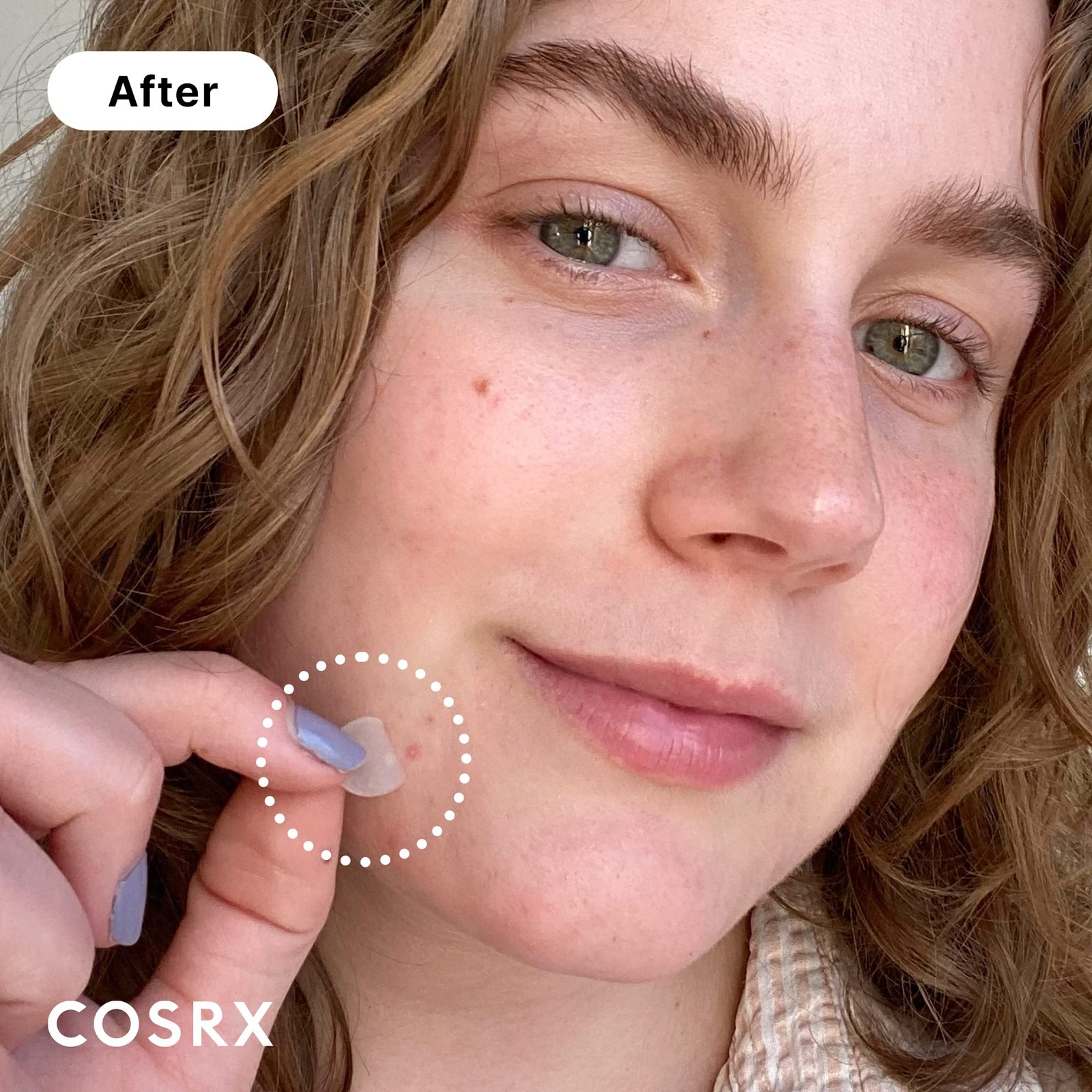 COSRX Acne Pimple Patch (96) Absorbing Hydrocolloid 96 Piece Assortment