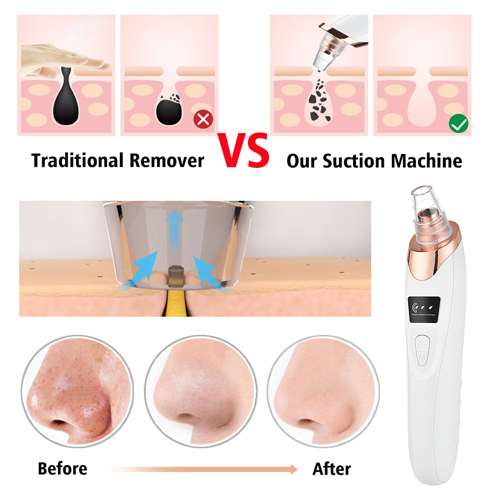 Pore Vacuum Blackhead Remover Facial Suction Blackheads Black Spots Removal Deep