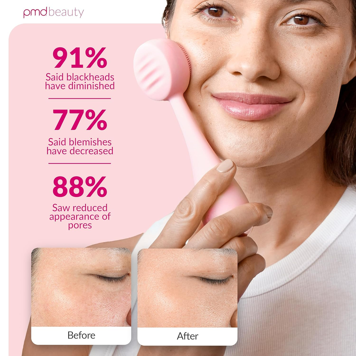 Clean, Acne, and Redvolution – Electric Facial Cleansing Brush, Smart Facial Dev