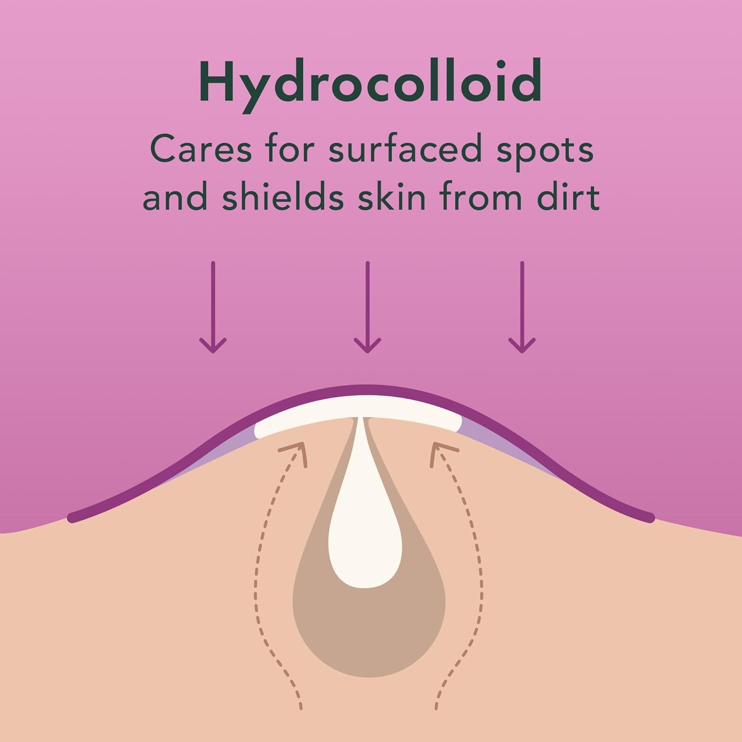 Rael Hydrocolloid Pimple Patches, Acne Patch Overnight Spot Cover (52 Count)