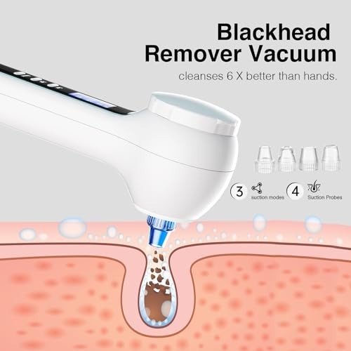 3-in-1 Facial Cleansing Brush & Blackhead Remover, Rechargeable, Waterproof, Dee