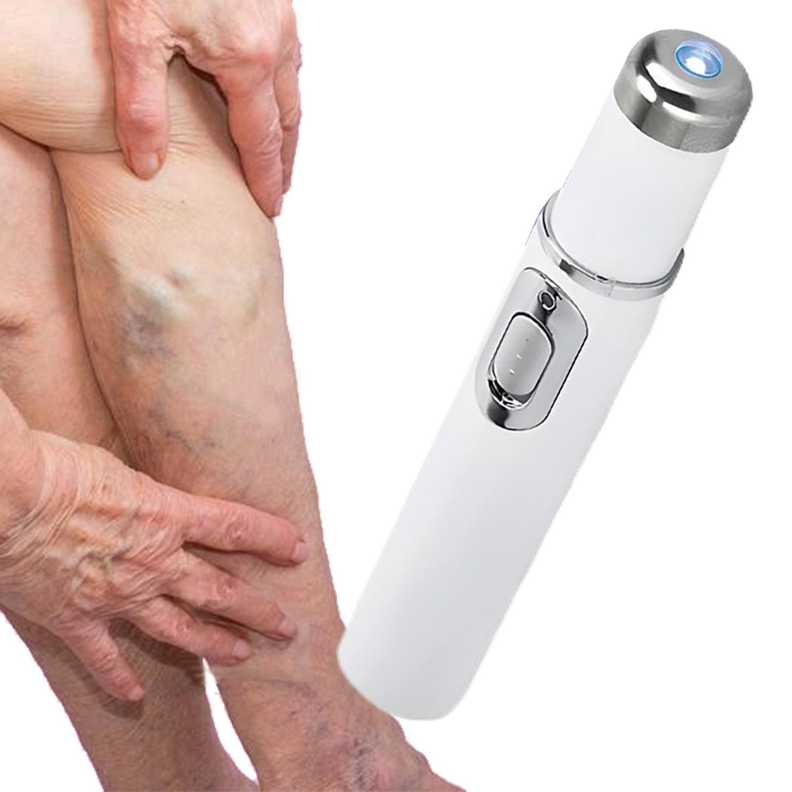 Spider Vein Eraser Skin Tag Remover Pen Wireless Vein Care Pen For Daily Relief