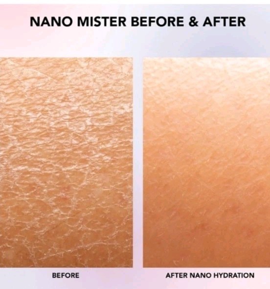 SPA SCIENCES Nano Sprayer Hydrate Mist Machine Skin Analyzer NWOT