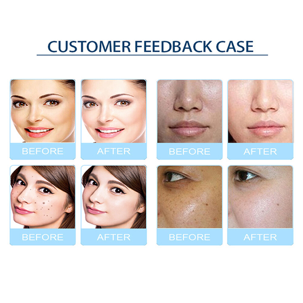 9in1 Water Hydro Dermabrasion Beauty Machine Face Lift Oxygen Peeling Cleaning