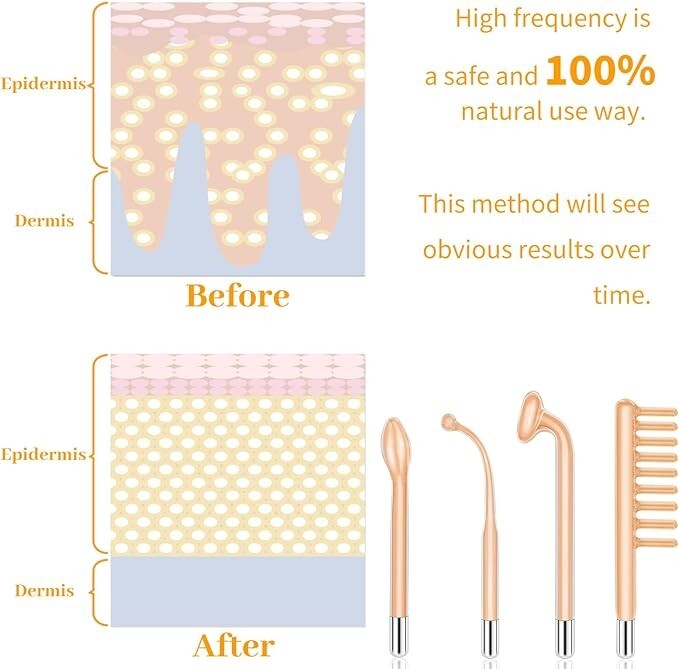 Máquina de varita facial portátil de alta frecuencia para el cuidado de la piel.