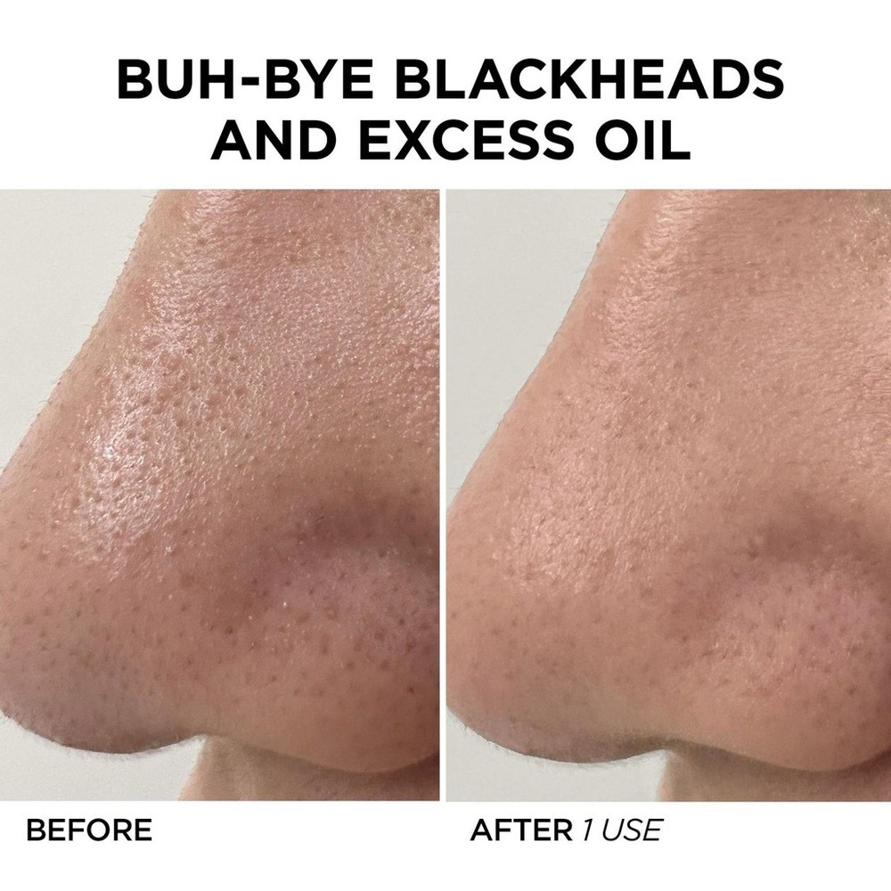 NEW BeautyBio Pore Cleansing Tool with LED Blue Light