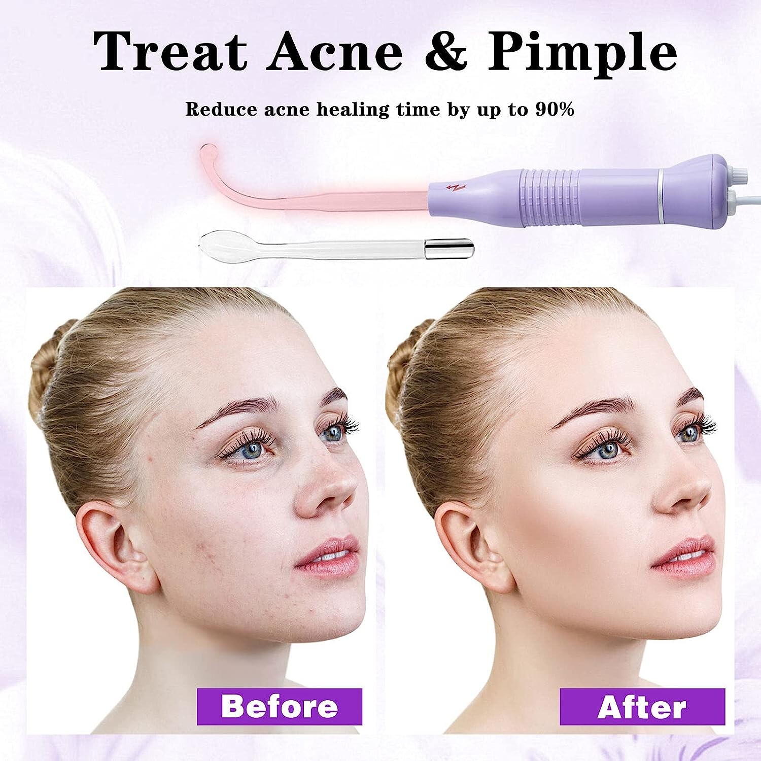 Bvcewilty Facial Tool for Skin Care