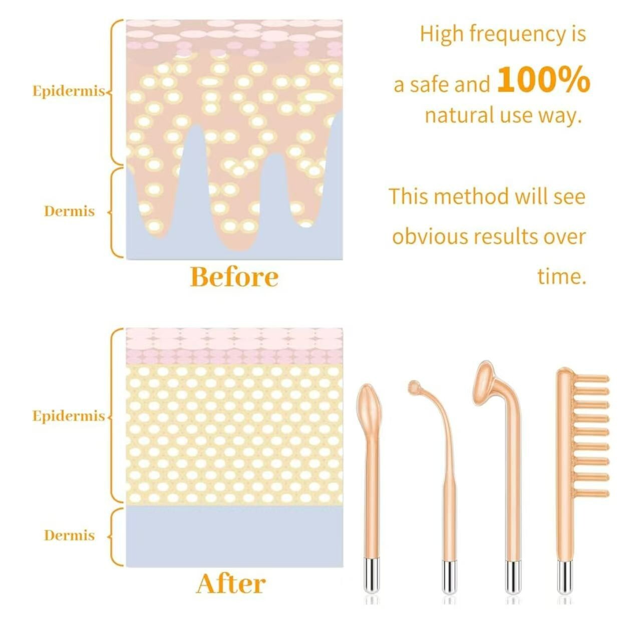 Portable High Frequency Facial Wand – 4 Electrodes for Skin & Hair Care