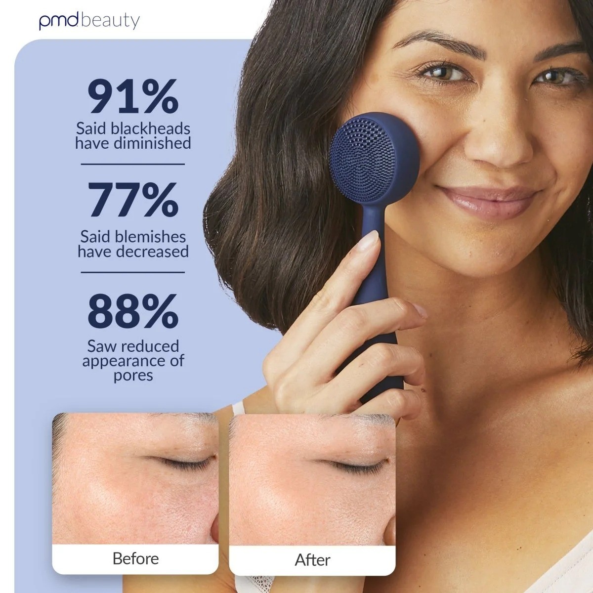 PMD Clean Smart Facial Cleansing Device Navy Sonic Silicone Face Brush Waterproo