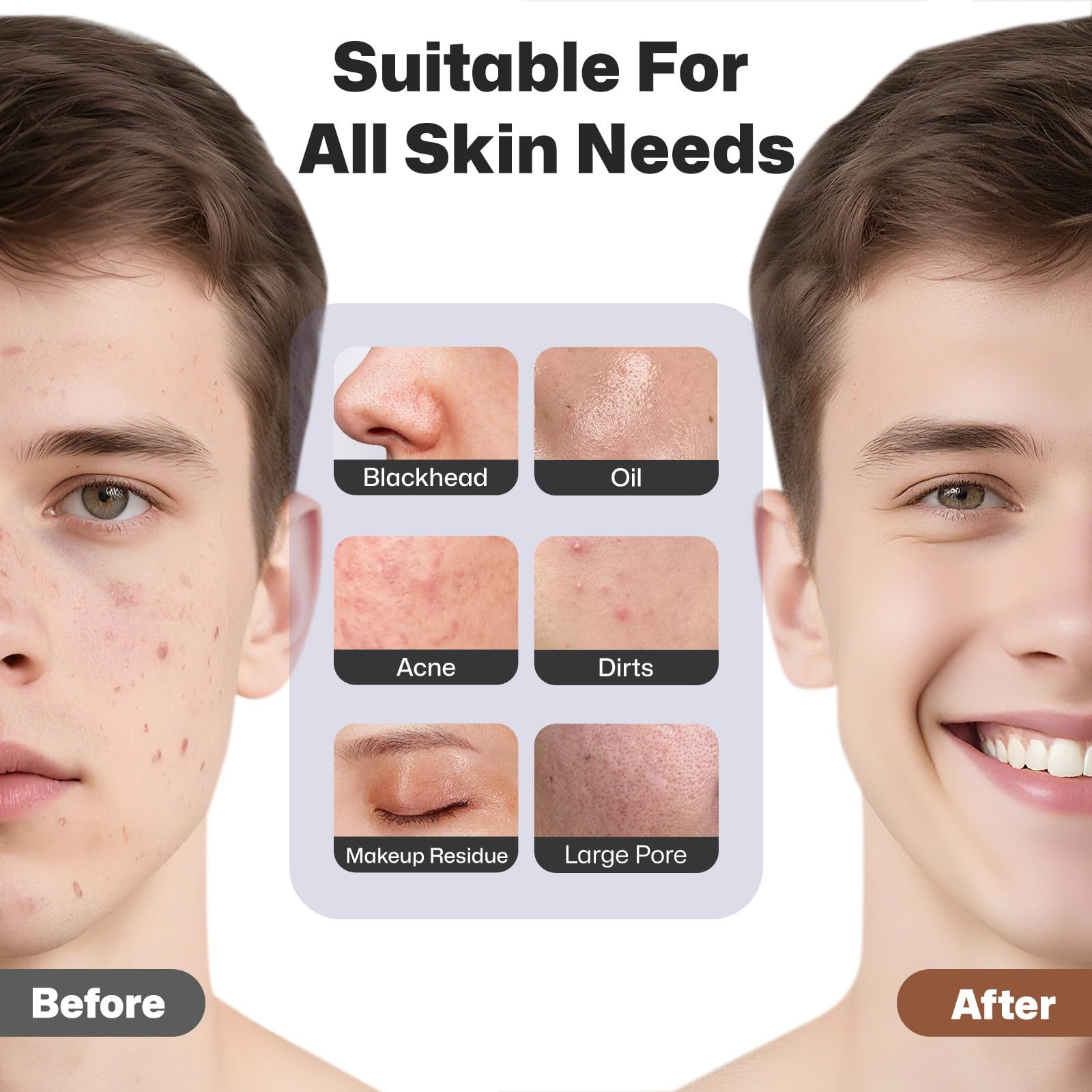 Facial Cleansing Brush, Rechargeable Silicone Face Scrubber with Heat Massage…