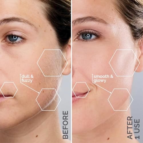 Beauty Sonicsmooth Dermaplane Razor for Women Face + Eyebrow trimmer Lavender