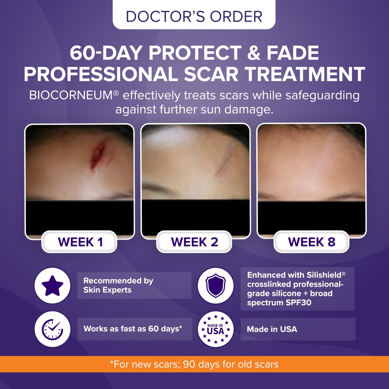 Biocorneum Advanced Scar Treatment with Silishield® & 0.35 Ounce (Pack of 1)