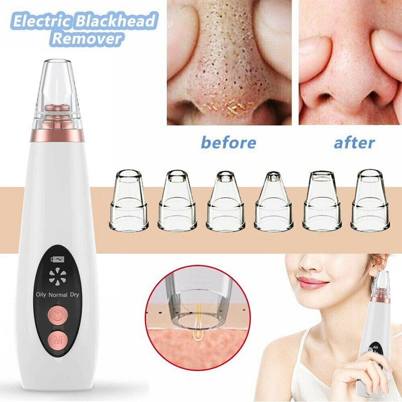  Electric Multi Speed Rechargeable Facial Ance Vacuum Suction Blackhead Remover