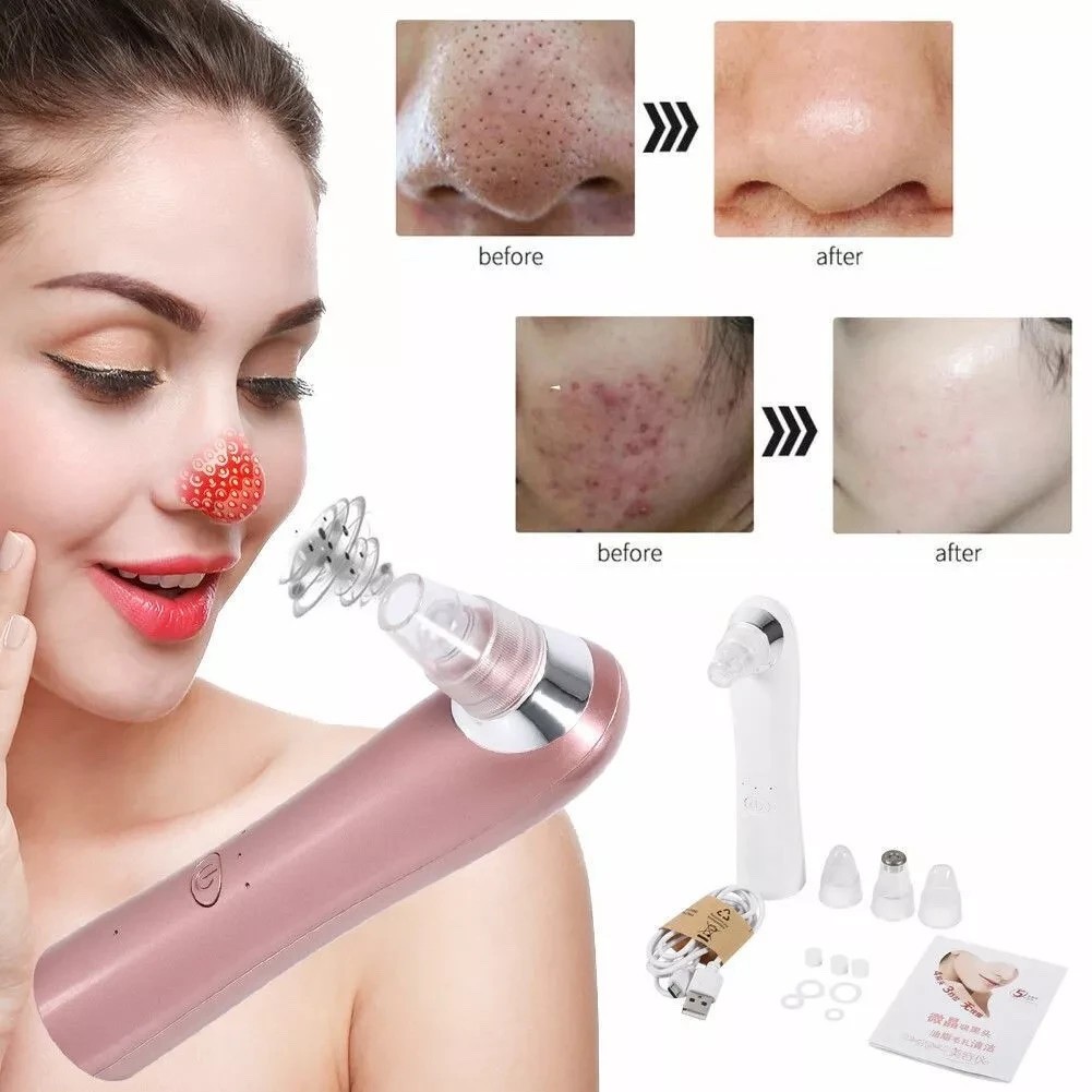 AQ-77961 BLACKHEAD ACNE FACIAL CLEANSING VACUUM SUCK UP DIRT RECHARGEABLE