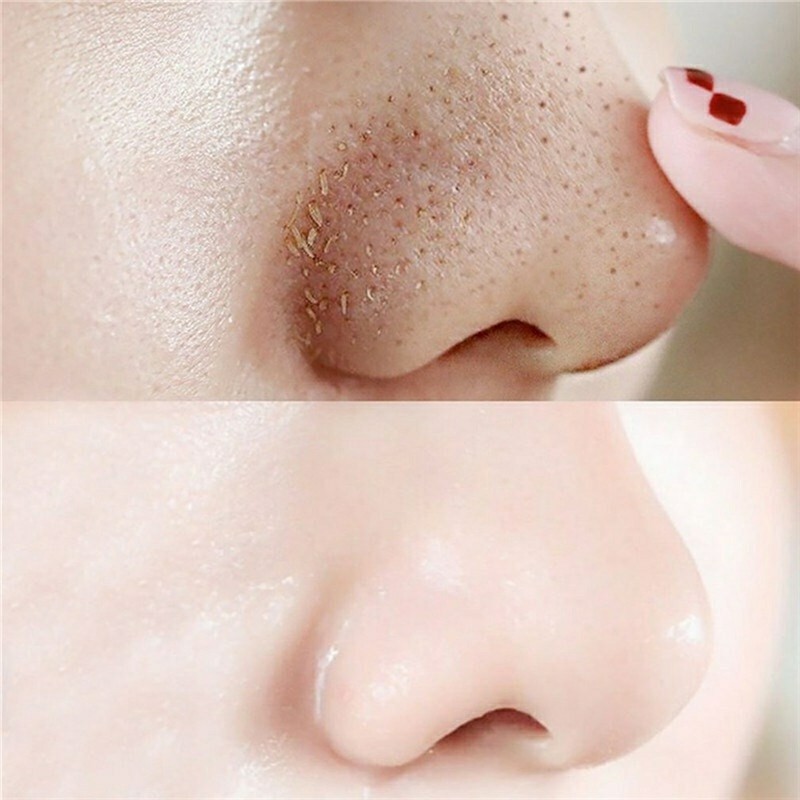 Blackhead Skin Care Remover Mask Nose Clean Strips Care Shrink Deep Cleansing
