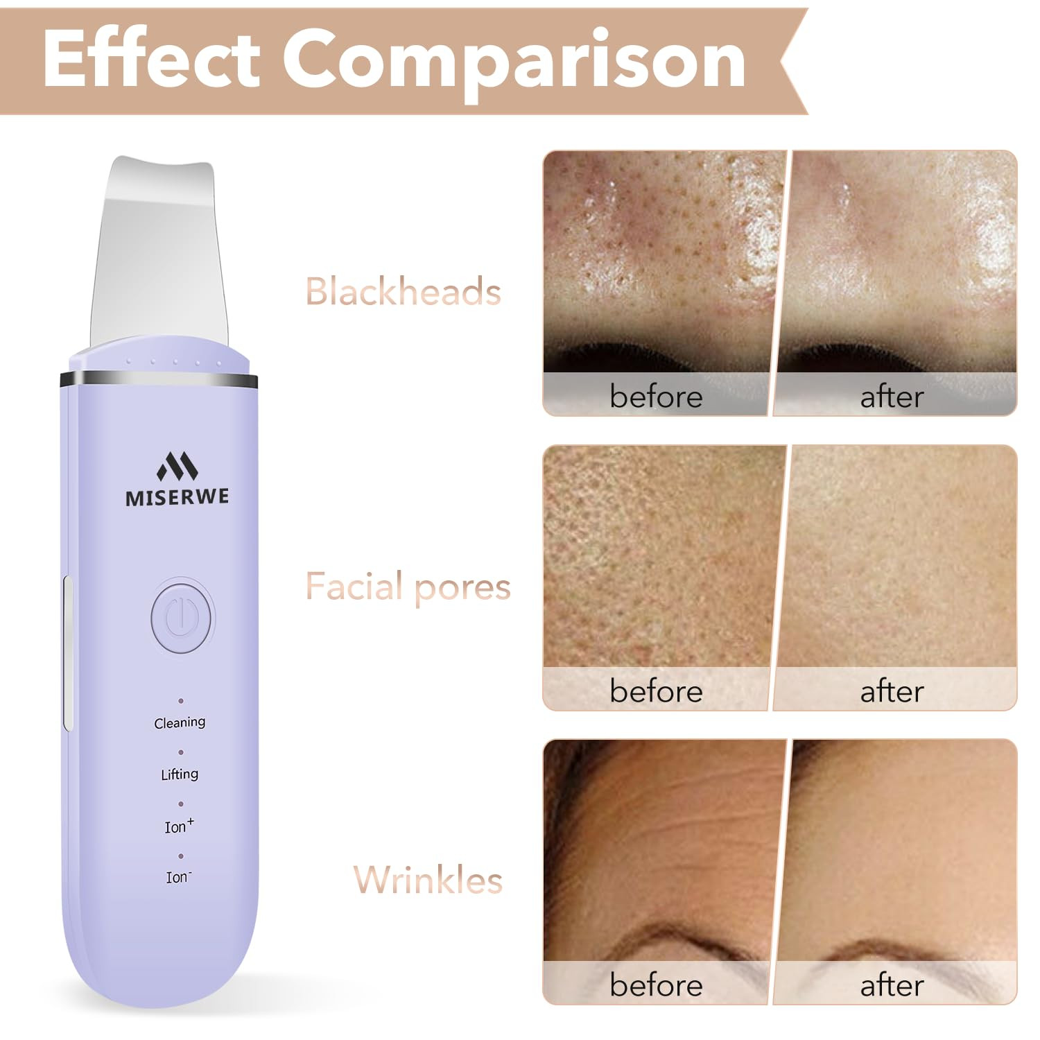 Skin Scrubber Face Skin Spatula Facial Scrubber Spatula for Deep Cleansing Black